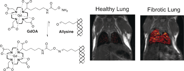 Noninvasive magnetic resonance imaging of lung fibrogenesis with an amino acid targeted probe