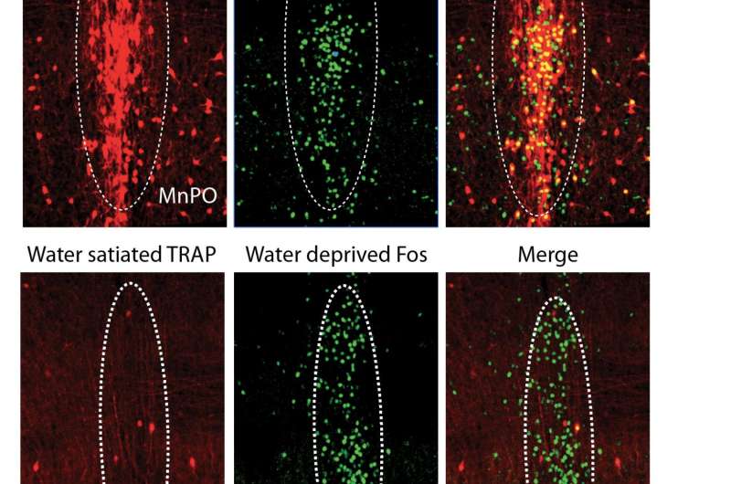 Research uncovers the neurons that drive thirst