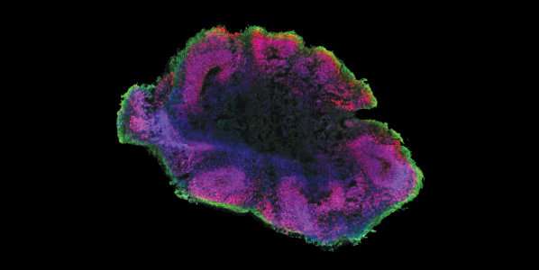 Two teams implant human organoids into rodent brains sparking ethical debate