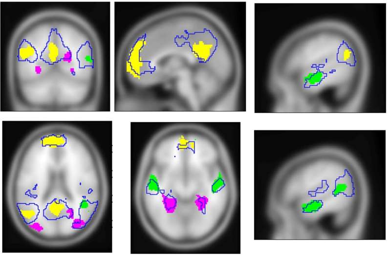 Brain researchers gain greater understanding of how we generate internal experiences