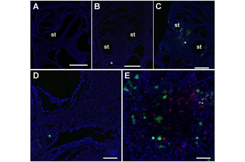 Immune system cells protect against CMV-induced hearing loss in mice