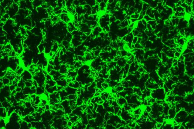 Neuroscientists identify genetic changes in microglia in a mouse model of neurodegeneration and Alzheimer's disease