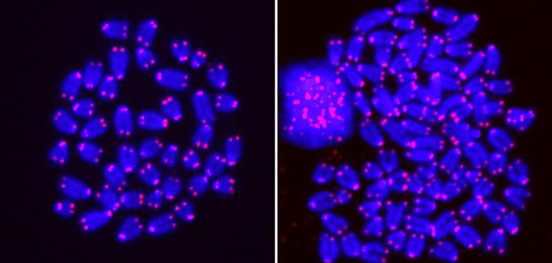 Researchers find link between common enzyme and cancer prevention