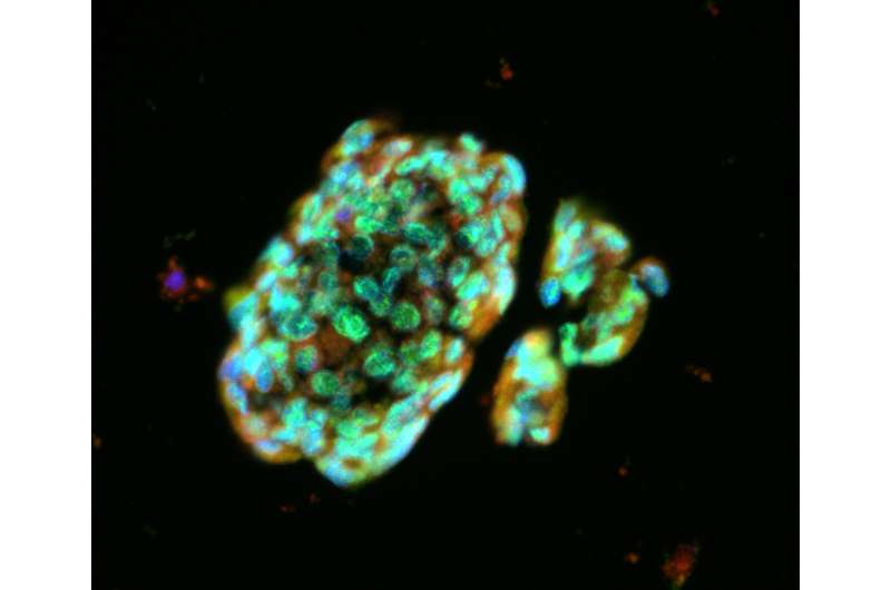 Scientists create stem cell therapy for lung fibrosis conditions