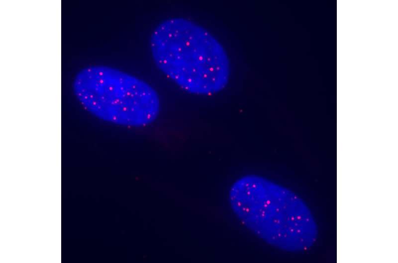 Researchers find shortened telomeres linked to dysfunction in Duchenne muscular dystrophy
