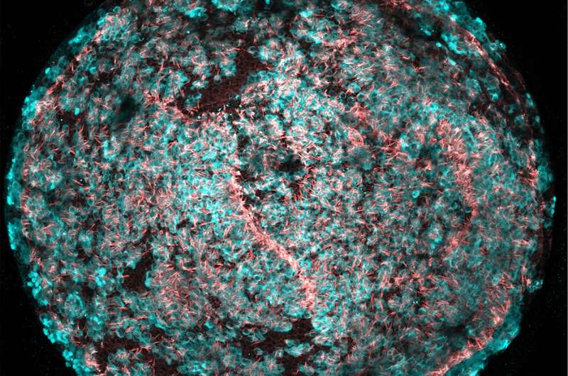 New technique generates high volume of sensory cells needed for hearing