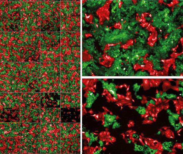 Researchers grow micro-tumour models for more targeted cancer therapy