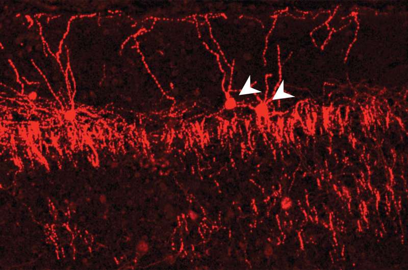 Research reveals 'exquisite selectivity' of neuronal wiring in the cerebral cortex