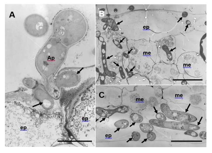 Aberrant hyphae triggered by host immune responses to plant pathogenic fungus