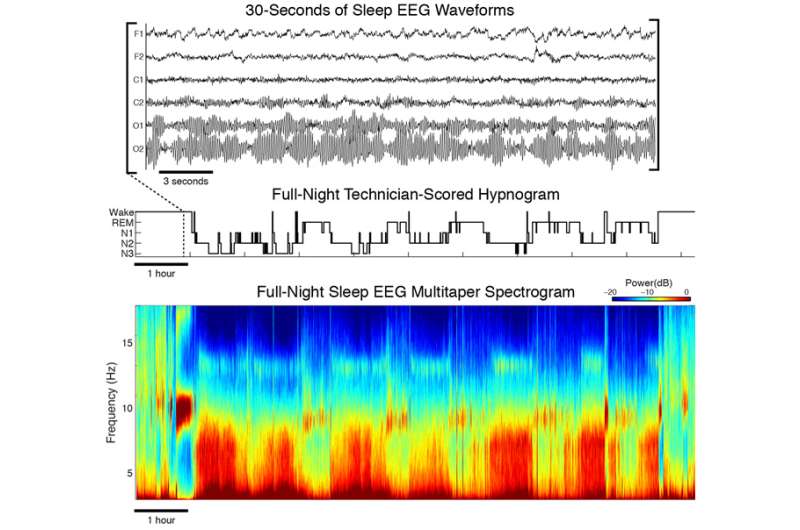 Advanced EEG analysis reveals the complex beauty of the sleeping brain