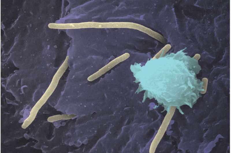 Aggressive UTI bacteria hijack copper, feed off it