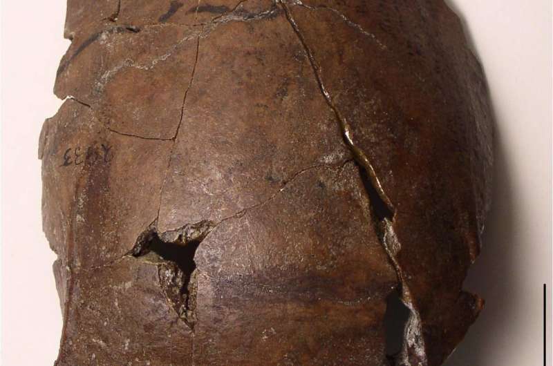 Aitape skull likely belongs to world's oldest tsunami victim