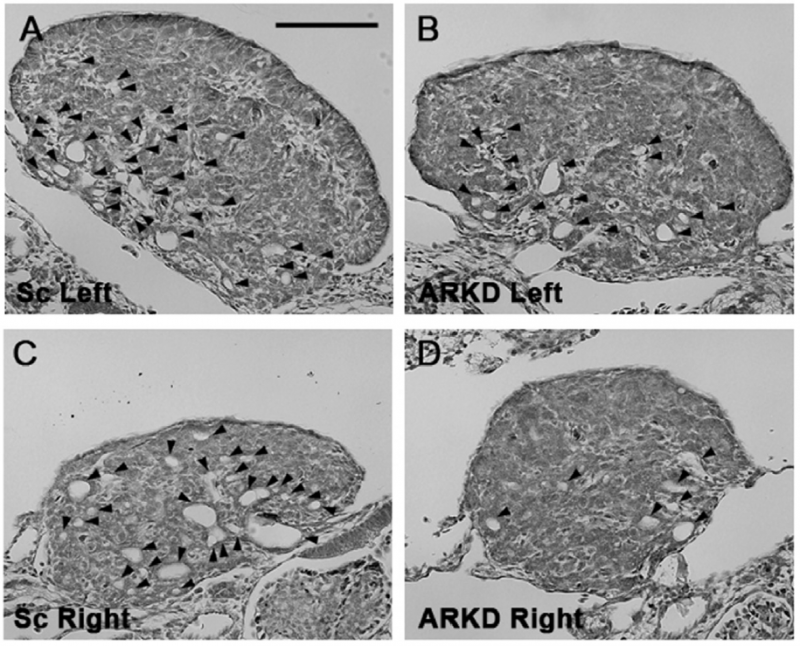 Androgen plays key role in ovarian development