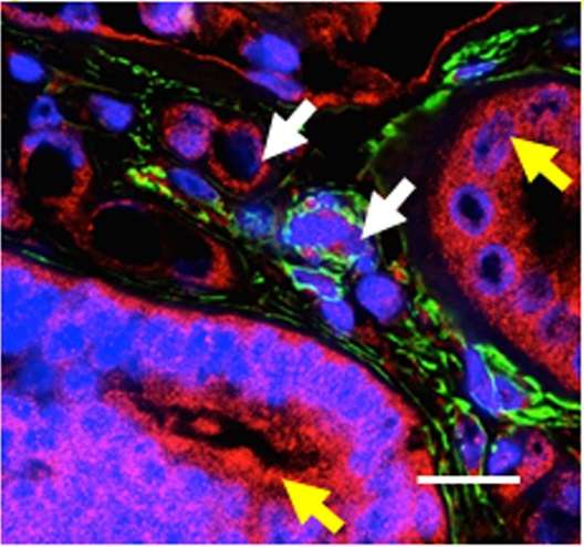 A promising target for kidney fibrosis