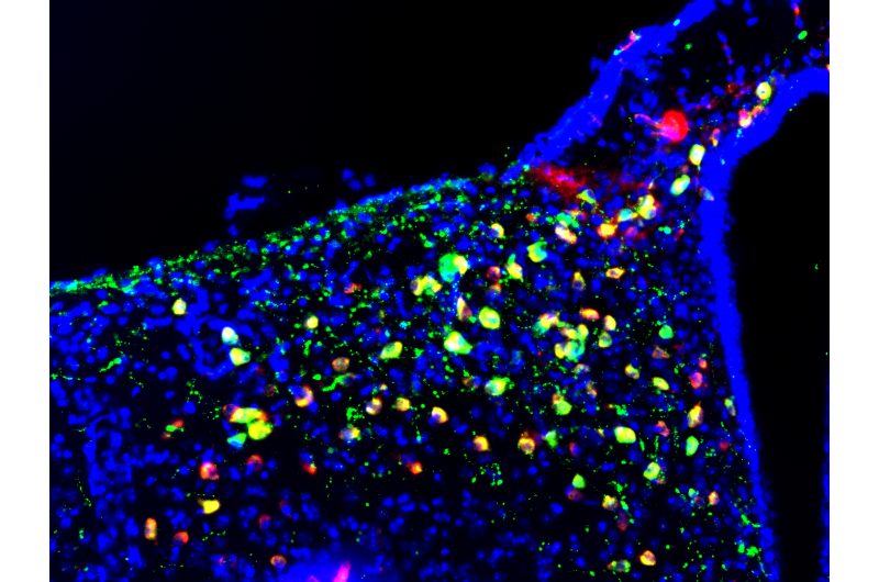 A small group of neurons modulates the amount of insulin that the pancreas must produce