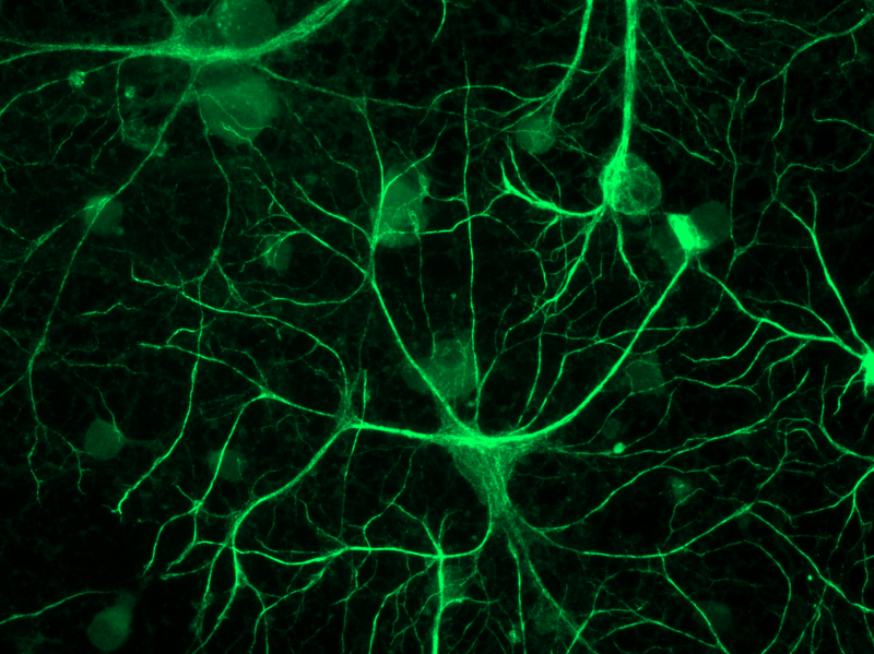 Astrocytes found to keep time for brain, behavior