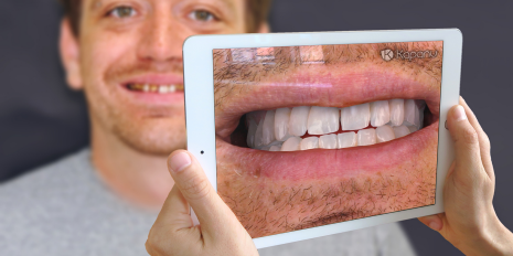 A sweeter smile through augmented reality