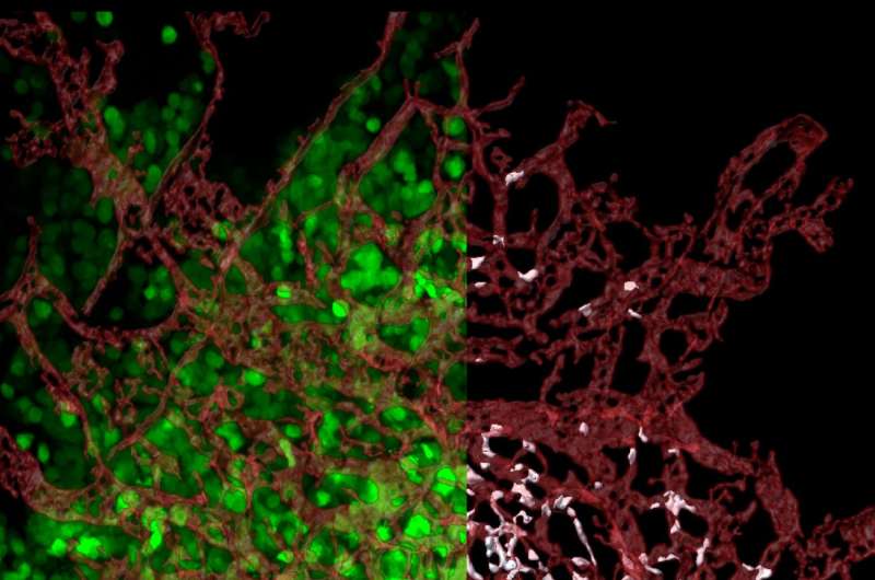 At last, a clue to where cancer metastases are born