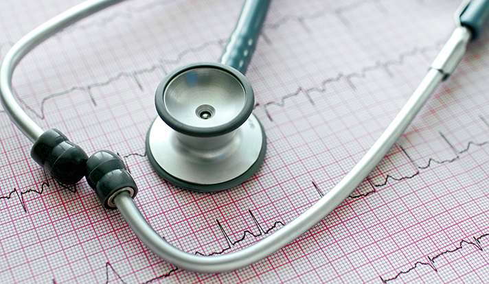 Atrial fibrillation hospitalizations rise as mortality rates decline