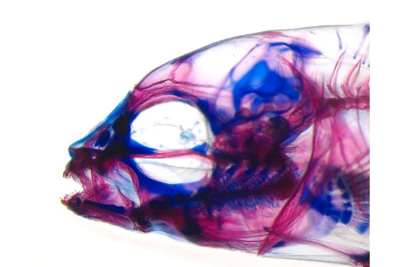 Baby fish exercising, a surprising source of adaptive variation in fish jaws