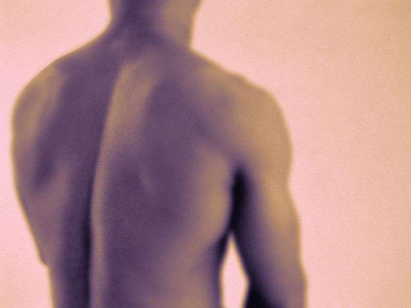 Basivertebral nerve ablation beneficial for chronic back pain