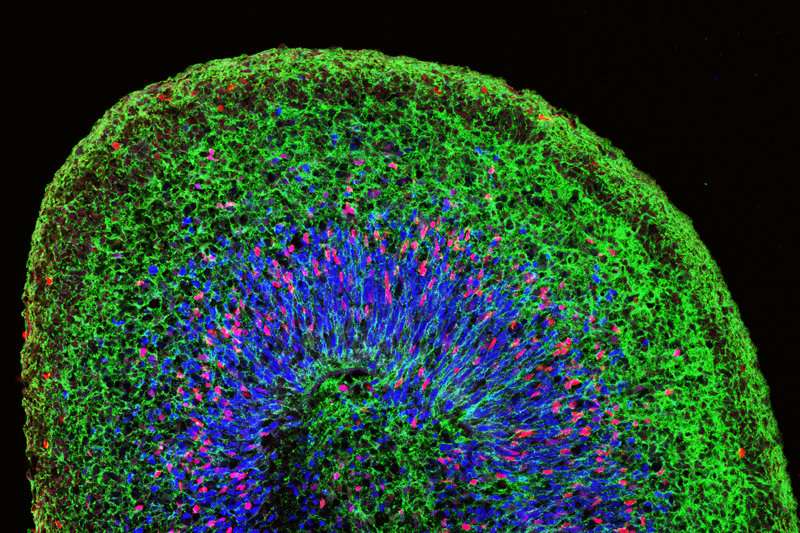 Better mini brains could help scientists identify treatments for Zika-related brain damage