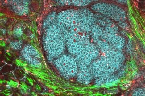 Big Data shows how cancer interacts with its surroundings