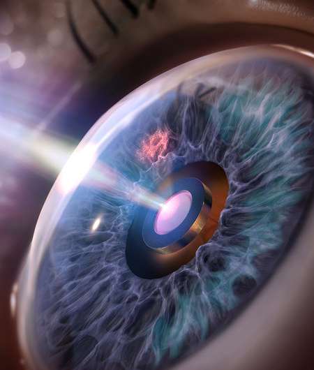 Black silicon prevents eye implant from gumming up