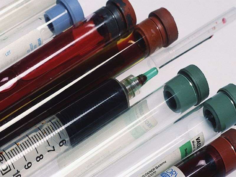 Blood test can detect GLUT1 deficiency syndrome
