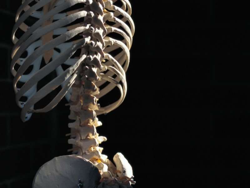 Bone fragility variants linked to concordant pediatric skeleton