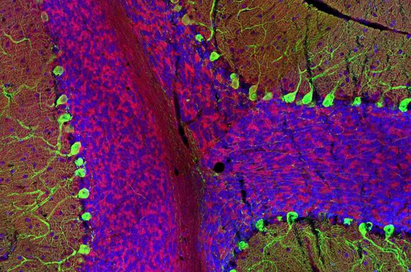 Brain cells mobilize sugar in response to increased activity