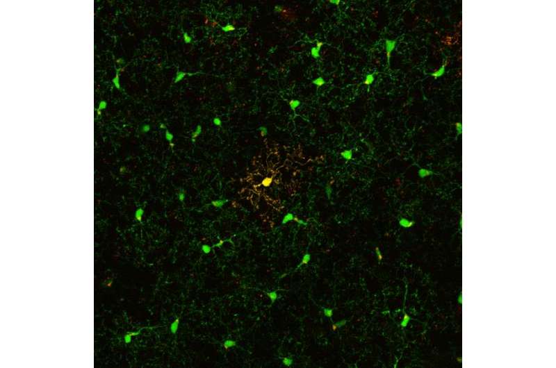 Brain defense cells live longer than expected