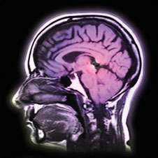 Brain health researchers delve into dopamine