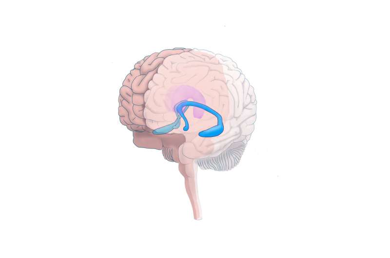 Brain's hippocampal volume, social environment affect adolescent depression