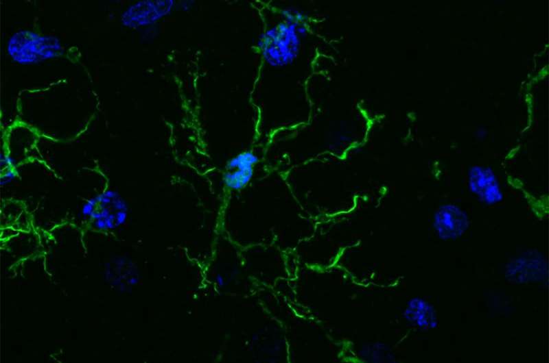 Brain’s immune cells linked to Alzheimer’s, Parkinson’s, schizophrenia