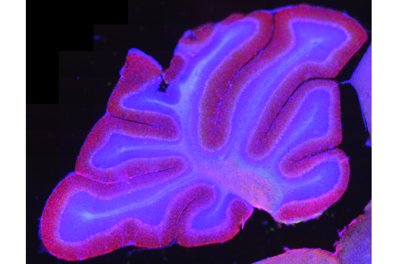 Brain stimulation improves schizophrenia-like cognitive problems