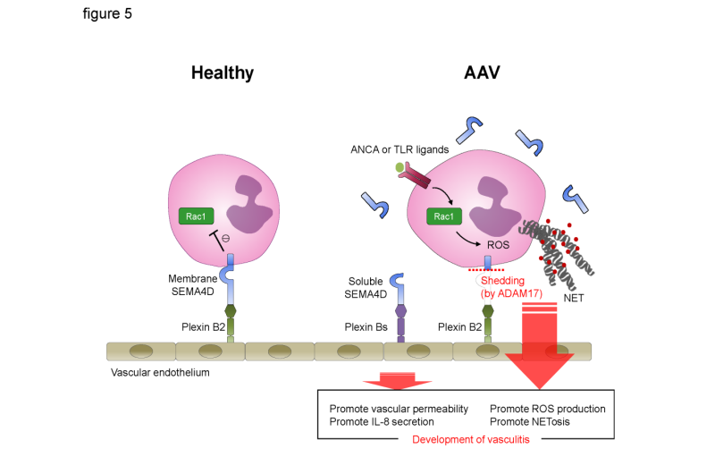Breakdown of neutrophil protein causes severe autoimmune disease of blood vessels
