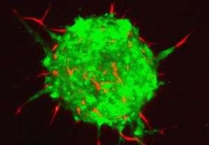 Cancer cells hijack healthy cells to help them spread to other organs