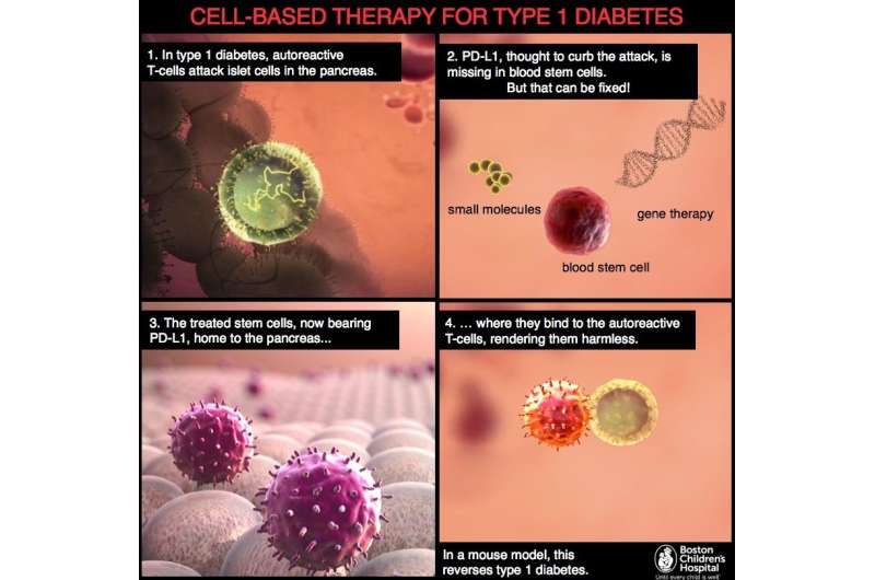 Cell-based therapy for type 1 diabetes?