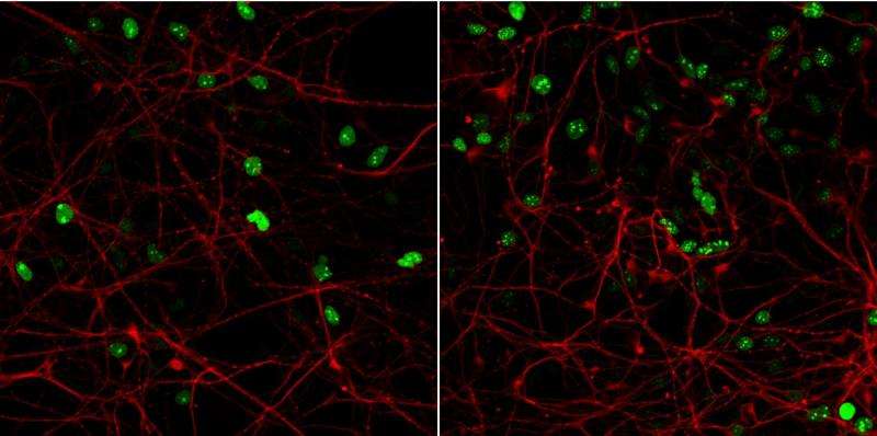 Cell model of the brain provides new knowledge on developmental disease
