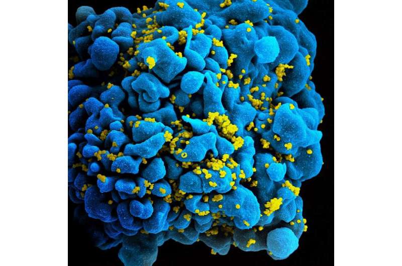 Cell particles may help spread HIV infection, NIH study suggests