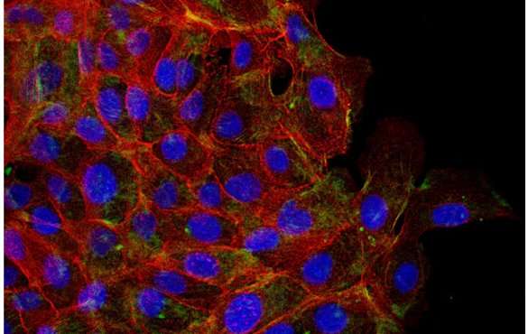 Cells' mechanical memory could hold clues to cancer metastasis