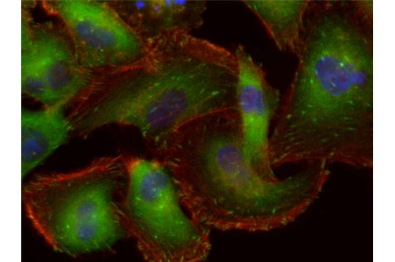 Cell 'stickiness' could indicate metastatic potential
