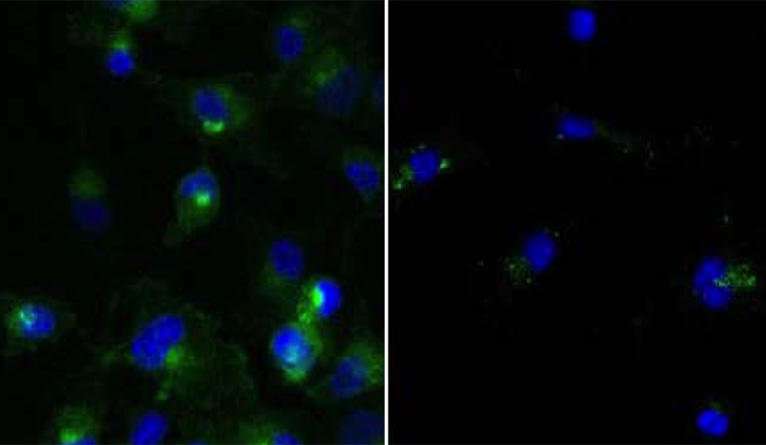 Cellular clean-up can also sweep away forms of cancer