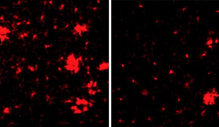 Changes in the vascular system may trigger Alzheimer's disease