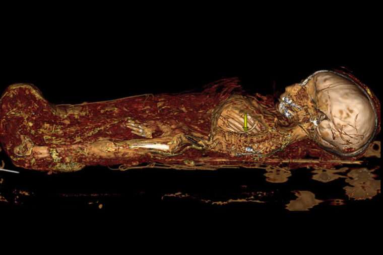 Clues to ancient past: baby mummy, dinosaur skulls scanned
