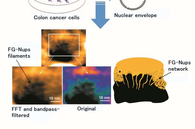 Colon cancer nuclear pore dynamics are captured by HS-AFM