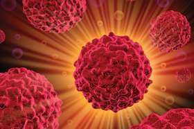 Combination of radiation and immune checkpoint therapy holds potential for lung cancer
