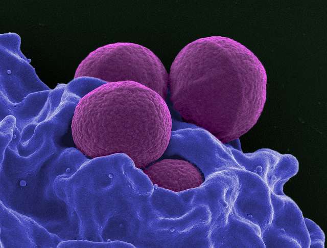 Common antimicrobials help patients recover from MRSA abscesses