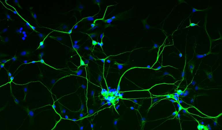 Creating neurons from skin cells to understand autism